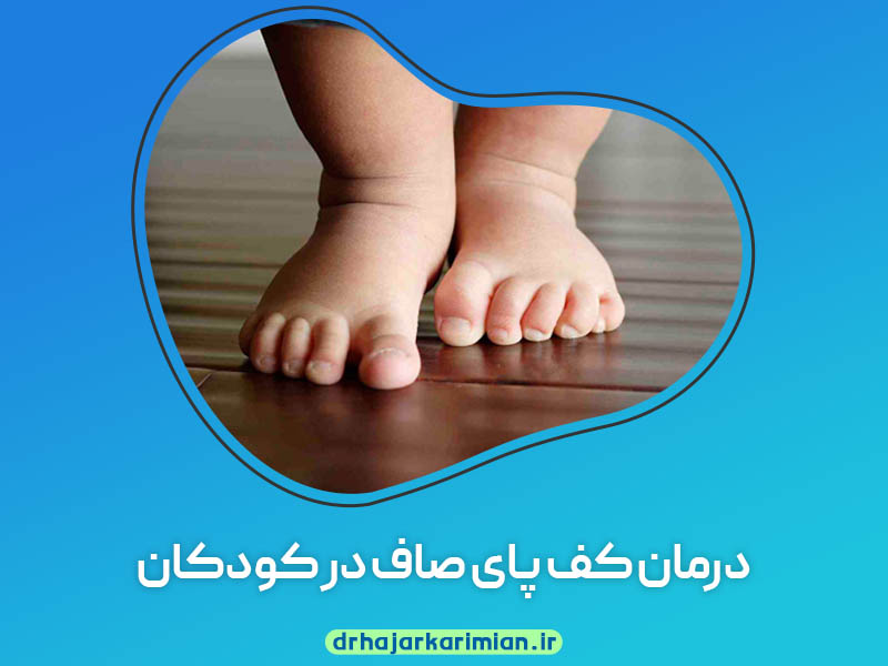 درمان کف پای صاف در کودکان